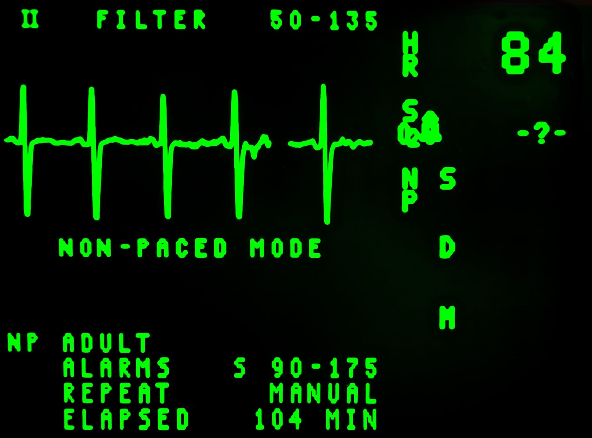 EKG (Electrocardiogram)